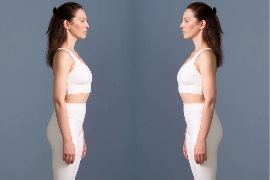 骨格ストレート ダイエット